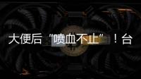 大便后“喷血不止”	！台州小伙住进EICU	！医生
：这个病很多人分不清……